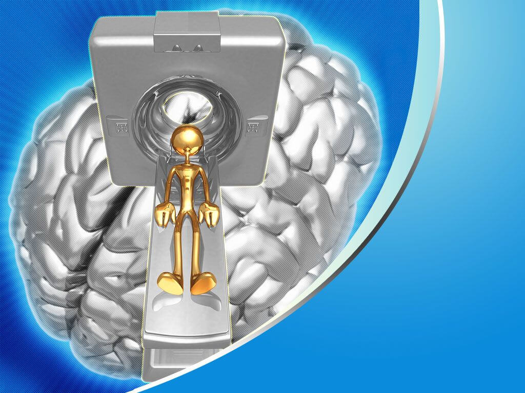Brain Powerpoint Presentation Templates Free Powerpoint With Regard To Radiology Powerpoint Template
